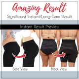 SHAPE™ Pelvis Correcting Thigh Slimmer